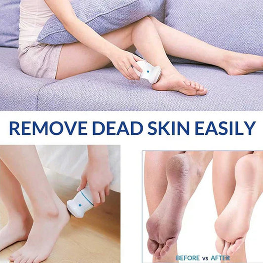 Rechargeable Electric Foot Grinder Dead Skin Remover